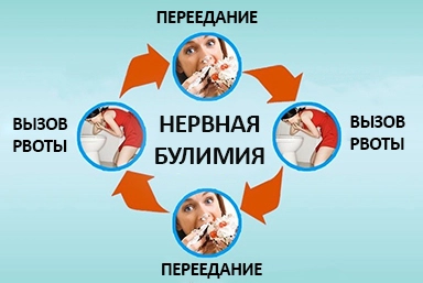 Лечение булимии в Кулебаках